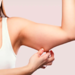 Arm and Thigh Lifts: What to Expect