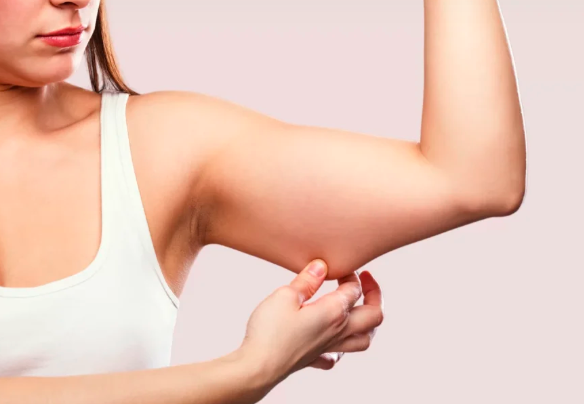 Arm and Thigh Lifts: What to Expect